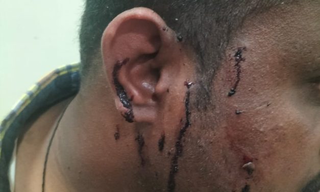 VIDIO : ಹುಬ್ಬಳ್ಳಿಯಲ್ಲಿ ಮತ್ತೆ ಜಳಪಿಸಿದ ಮಾರಕಾಸ್ತ್ರಗಳು