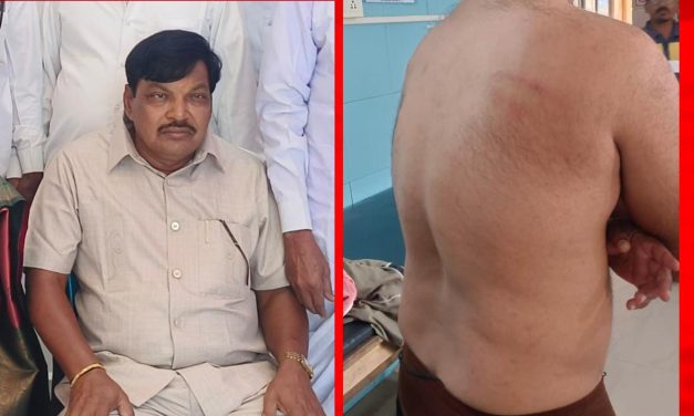 ವಿಡಿಯೋ – ಮಾಜಿ ಜಿಲ್ಲಾ ಪಂಚಾಯತಿ ಅಧ್ಯಕ್ಷನಿಂದ ಪತ್ರಕರ್ತನ ಮೇಲೆ ಮಾರಣಾಂತಿಕ ಹಲ್ಲೆ