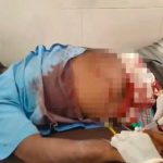 ಸಹೋದರನಿಗೆ 7 ಬಾರಿ ಚಾಕುವಿನಿಂದ ಇರಿತ – ಗಲಾಟೆಗೆ ಕಾರಣ ಏನು?