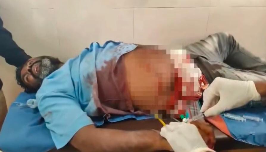 ಸಹೋದರನಿಗೆ 7 ಬಾರಿ ಚಾಕುವಿನಿಂದ ಇರಿತ – ಗಲಾಟೆಗೆ ಕಾರಣ ಏನು?